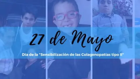 Día de Sensibilización de las Colagenopatías Tipo II