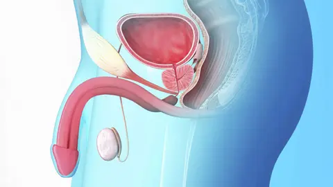 Día Mundial del Cáncer de Próstata